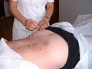 Acupuncture Sino Santé