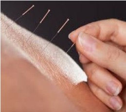 AGOPUNTURA-MTC Lioi Vittorio