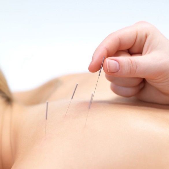 Praxis für Traditionelle Chinesische Medizin